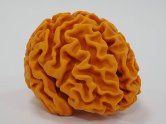 Educational model used by Alzheimer’s Research UK