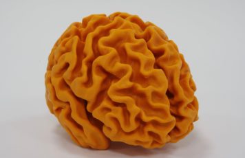 Educational model used by Alzheimer’s Research UK